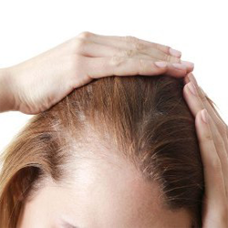 hair-restoration